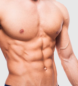 Gynecomastia Surgery