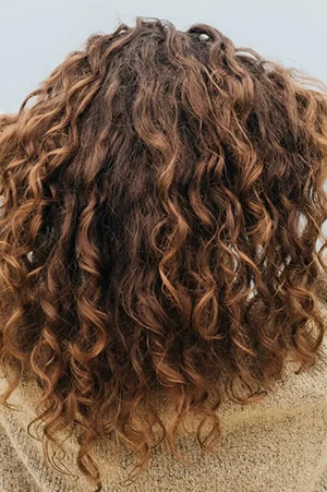 Hairline Transplant Mumbai