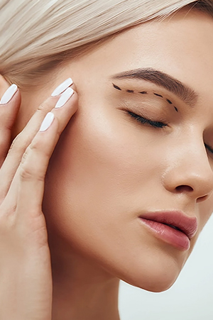 Eyelid Surgery Mumbai